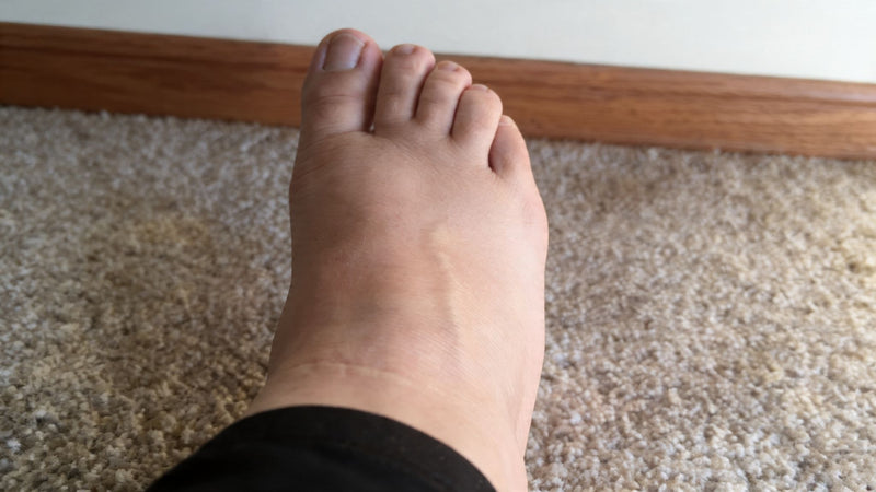 2. Water tablets might be making your swelling worse. Vytal doesn't.